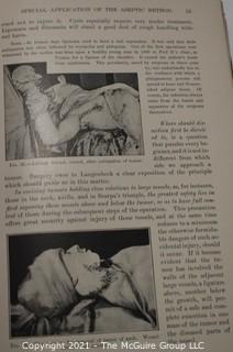 Books: Collection of 2 books including "The Rules og Aseptic and Antiseptic Surgery" by Arpad G. Gerster